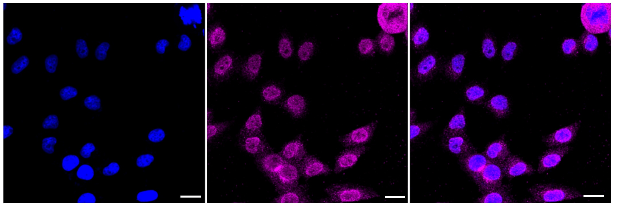 Apolipoprotein E R2/ApoE R2 Antibody (23GB2520)