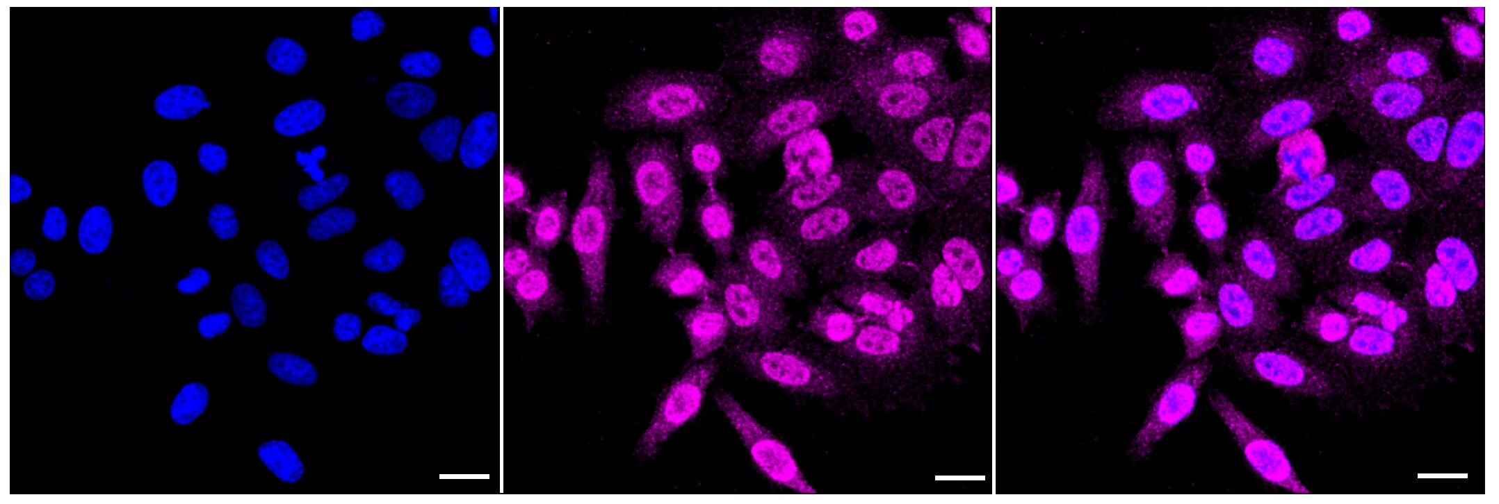 LIS1 Antibody (23GB2825)