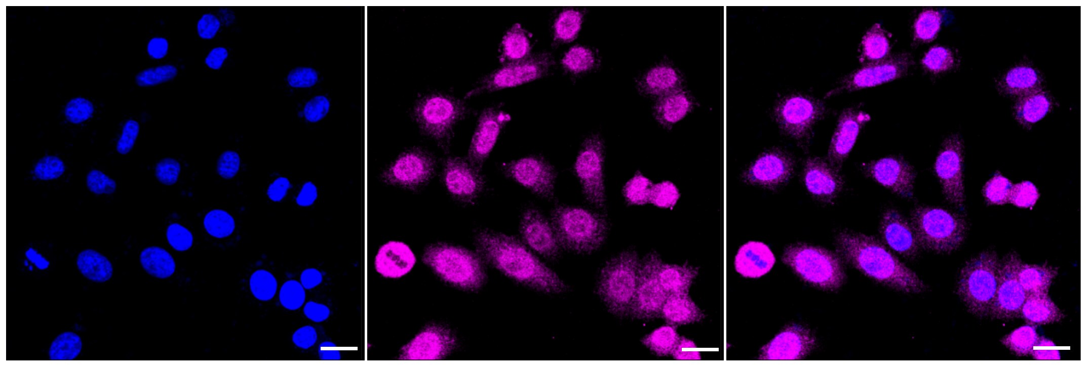ERK1 Antibody (23GB2450)