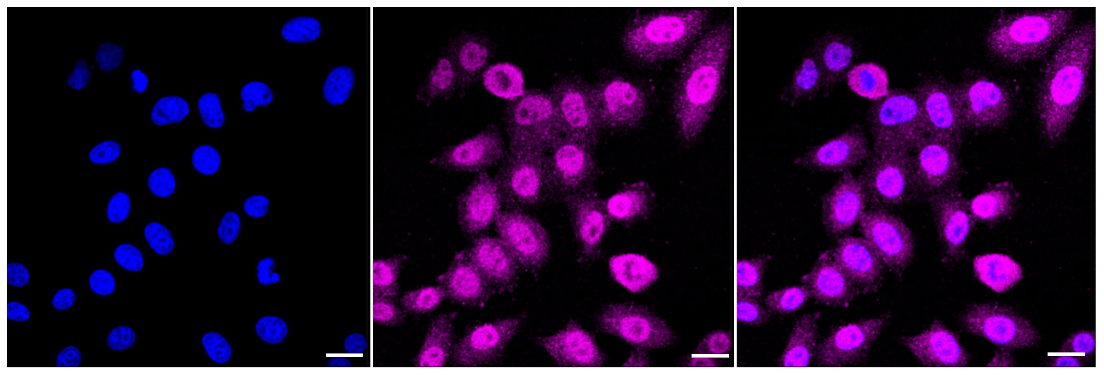 MAPKAPK2 Antibody (23GB2950)