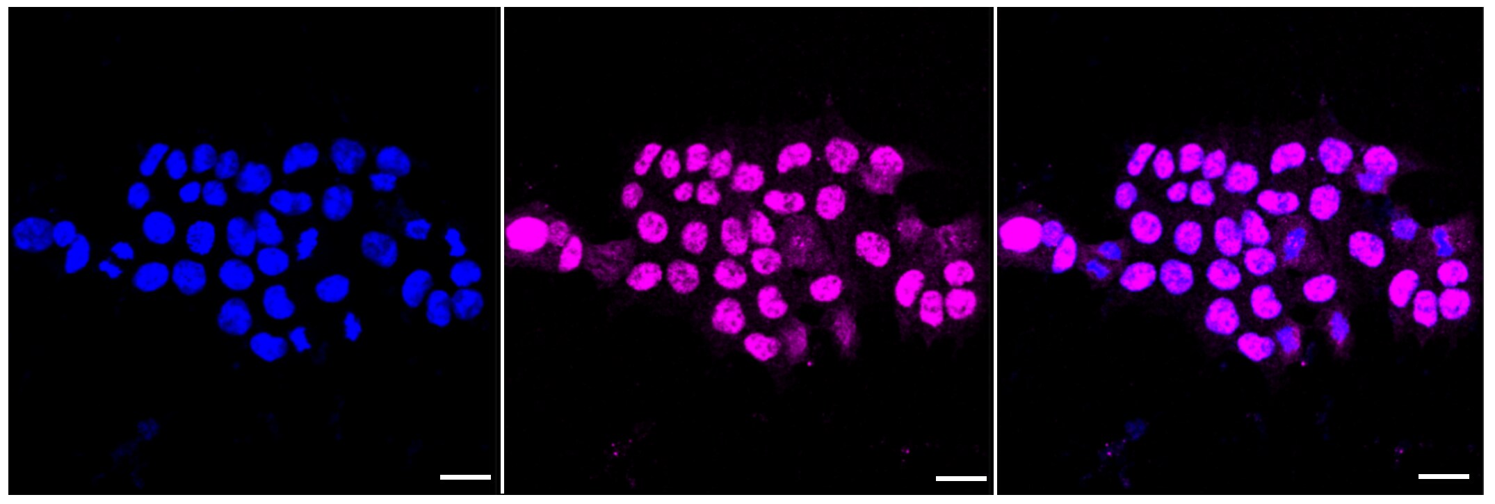 MAPKAPK2 Antibody (23GB2820)