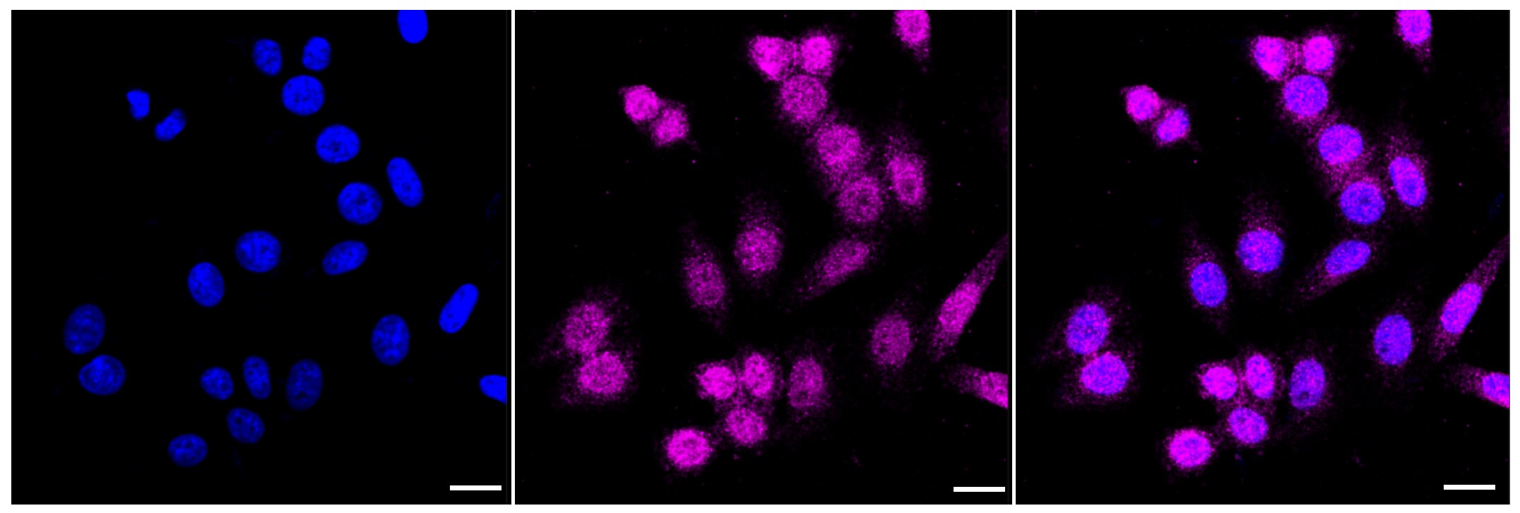 MCAM/CD146 Antibody (23GB2705)