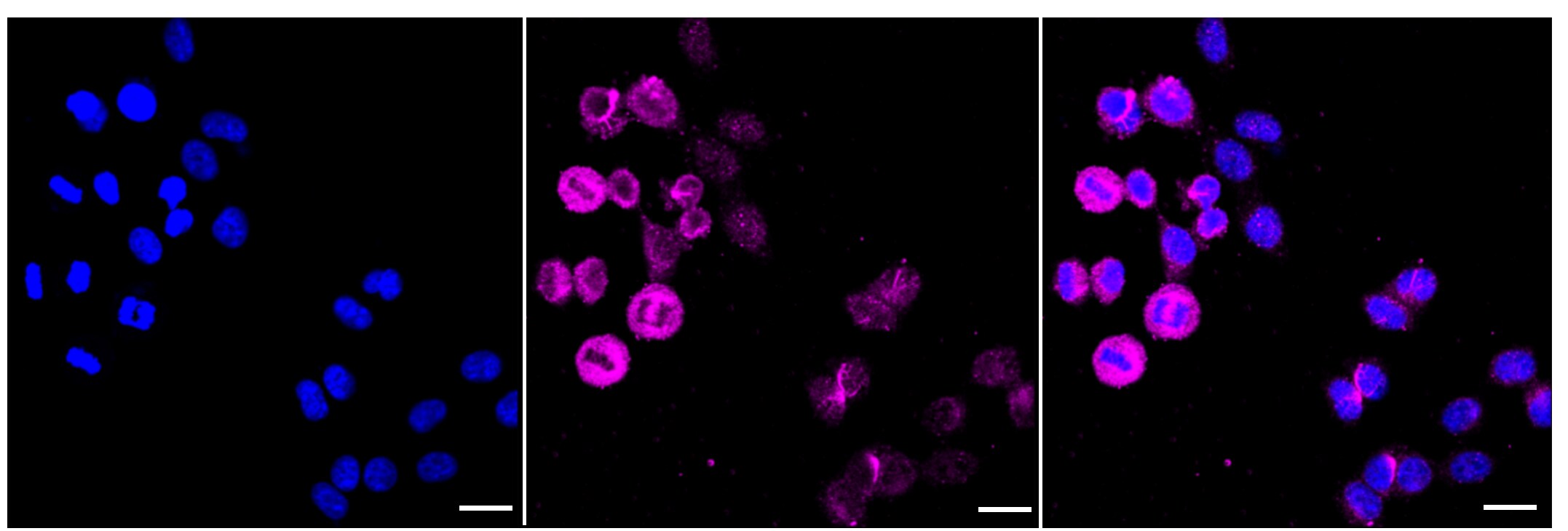 Methionine Aminopeptidase 2/METAP2 Antibody (23GB2565)