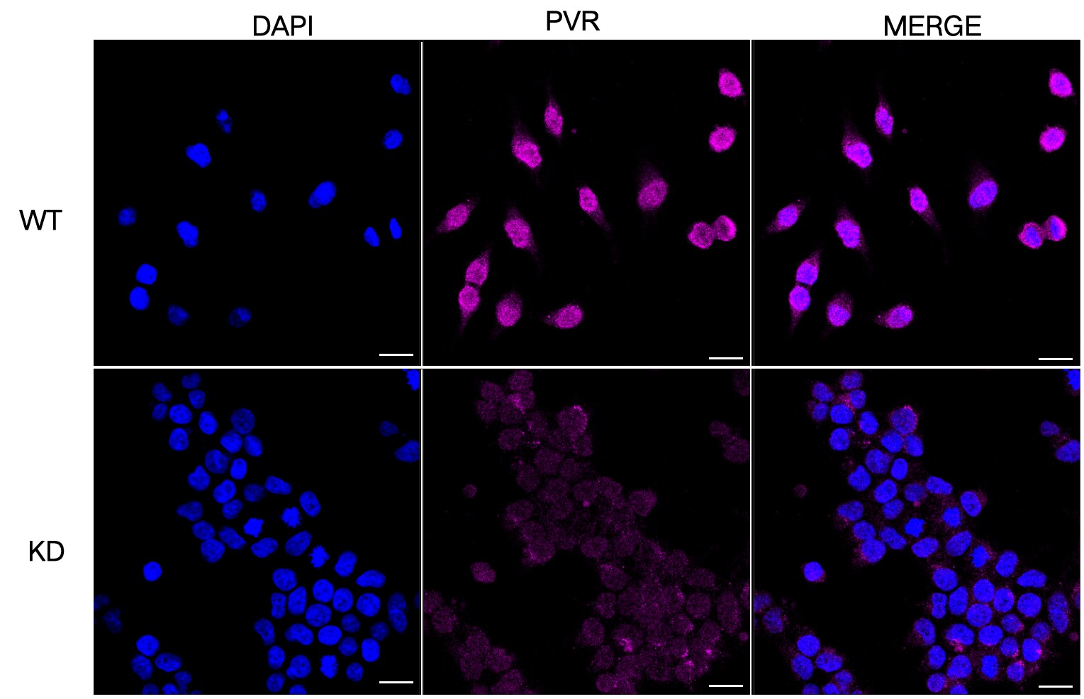 CD155/PVR Antibody (23GB2575)