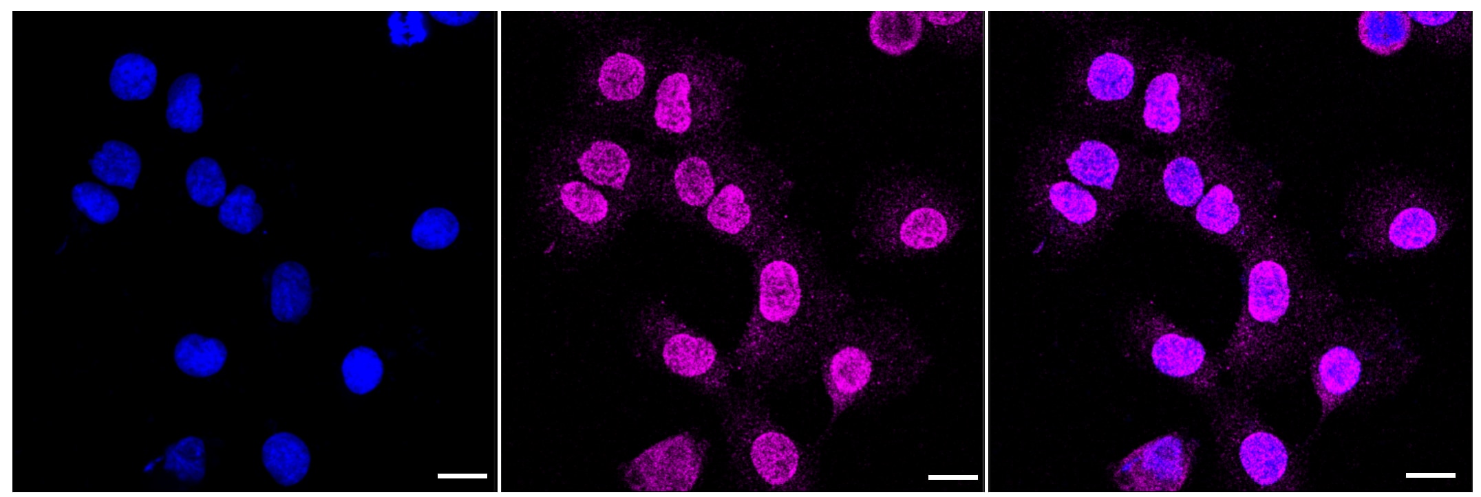 CD155/PVR Antibody (23GB2575)