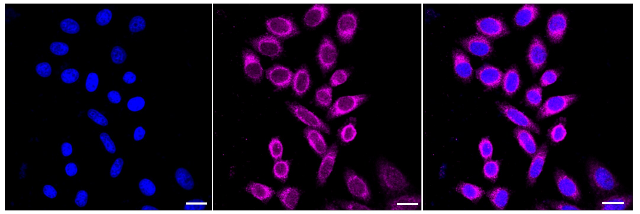 MLKL Antibody (23GB2935)