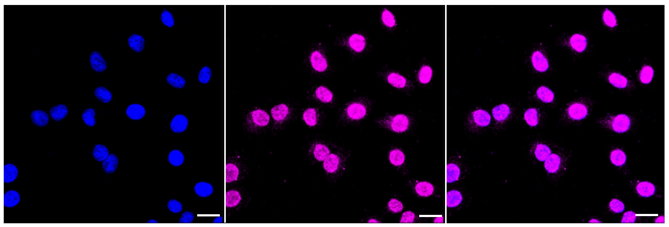 MLKL Antibody (23GB2895)