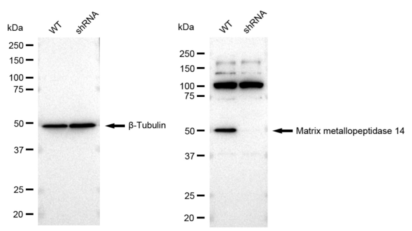 MMP-14/MT1-MMP Antibody (23GB2695)