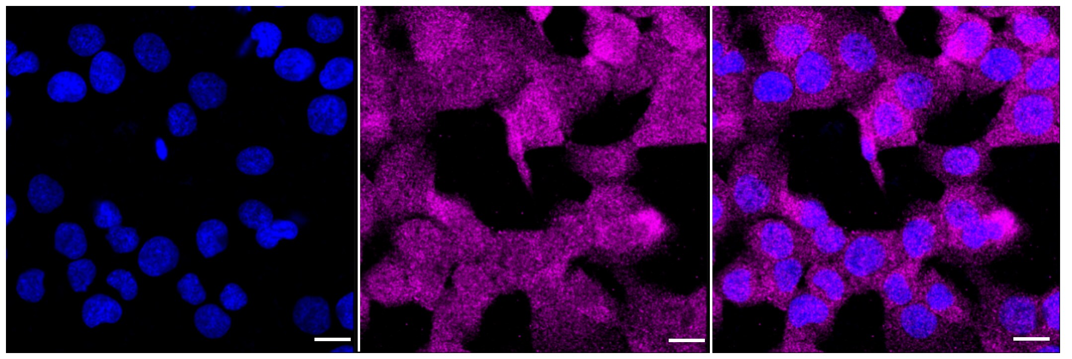PEPD Antibody (23GB2830)