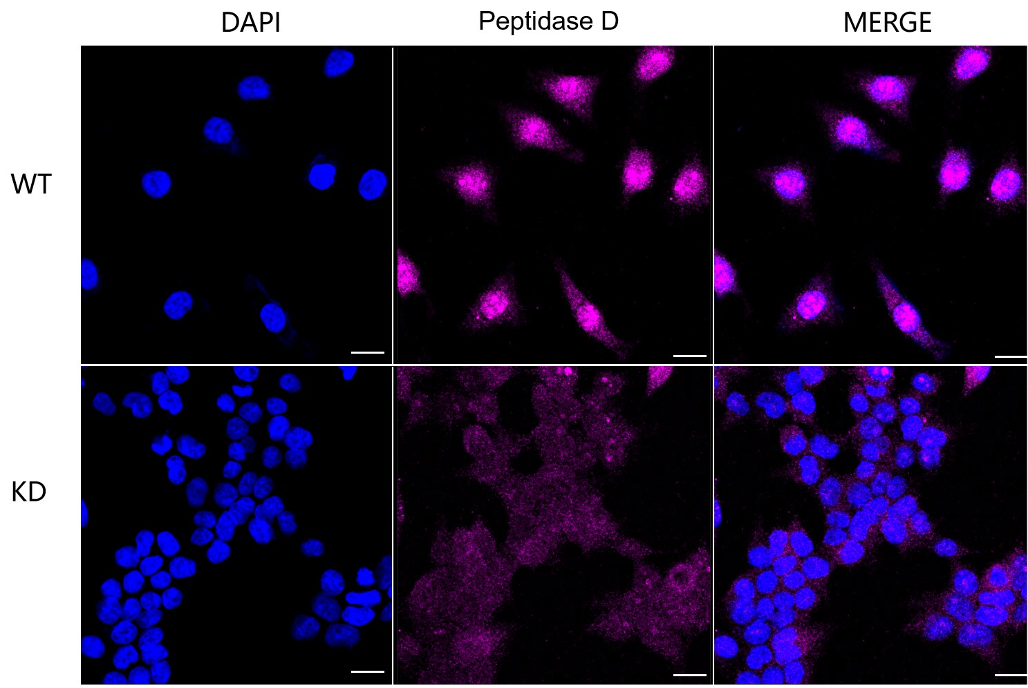 PEPD Antibody (23GB2830)