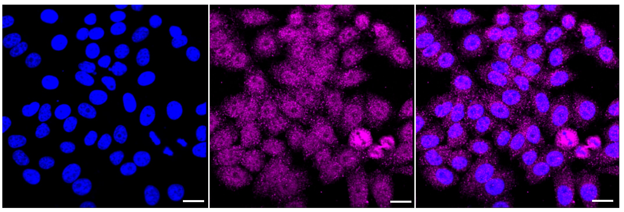 Muscle Phosphofructokinase/PFKM/PFK-1 Antibody (23GB2740)