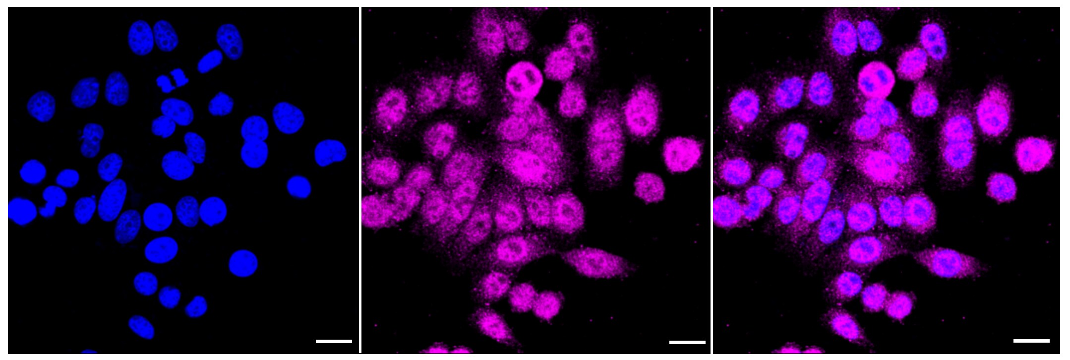 PLAP Antibody (23GB2560)