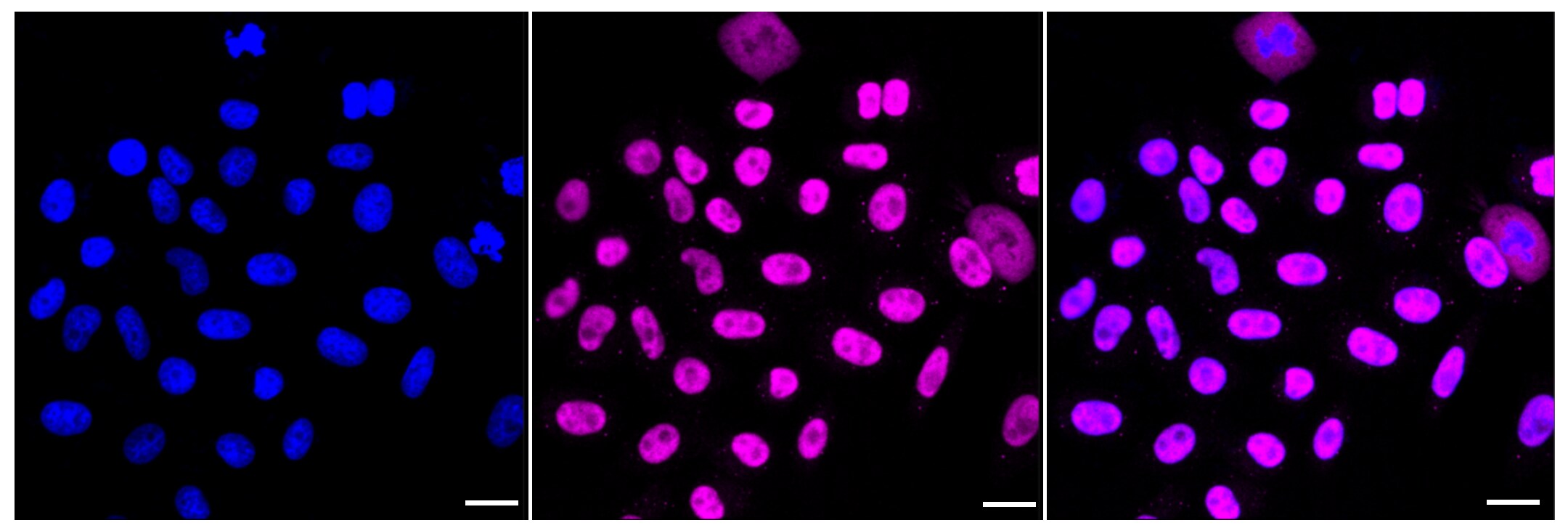 PP2C gamma/PPM1G Antibody (23GB2590)