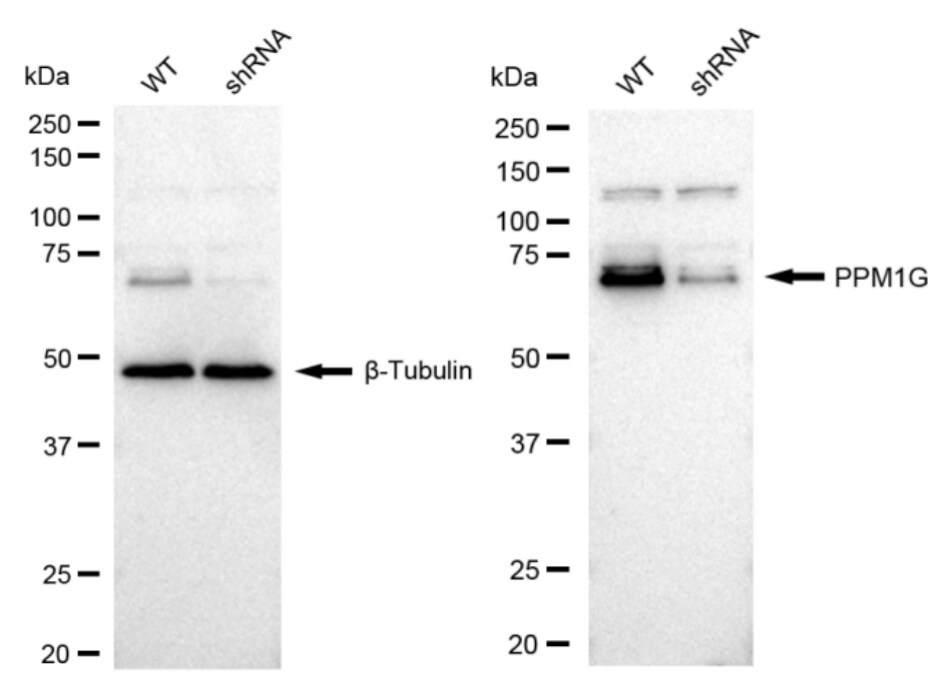 PP2C gamma/PPM1G Antibody (23GB2590)