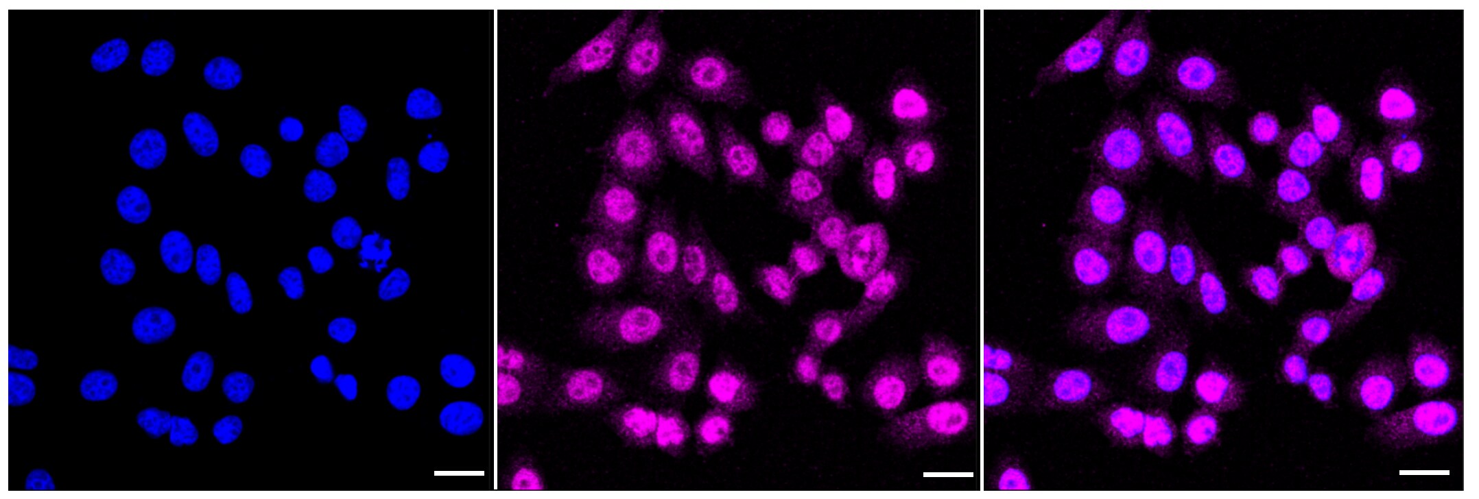 PP2C gamma/PPM1G Antibody (23GB2585)