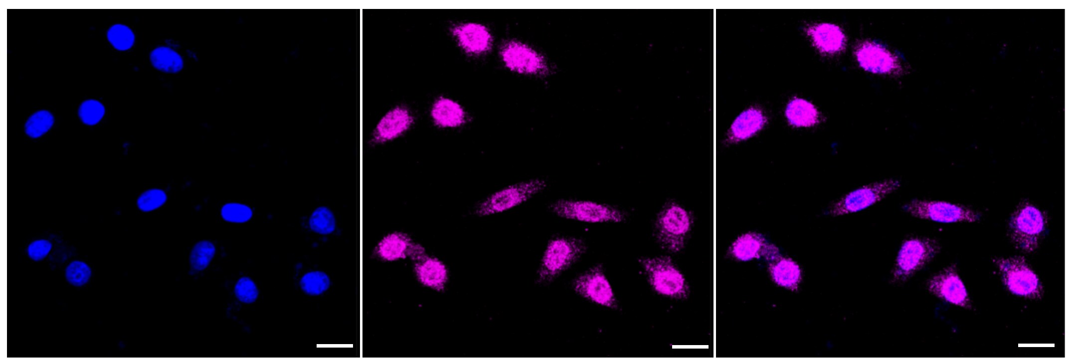 AMPK alpha 1 Antibody (23GB2685)