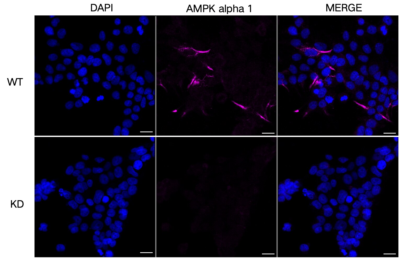 AMPK alpha 1 Antibody (23GB2685)