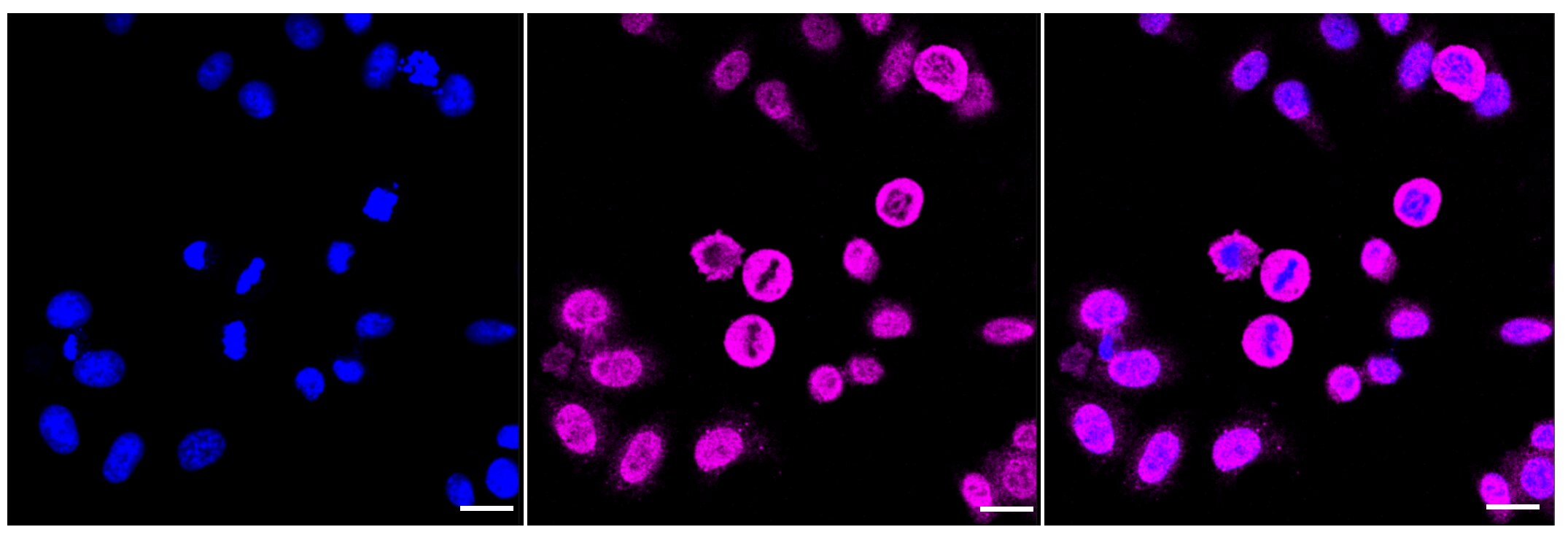 PRMT7 Antibody (23GB2380)