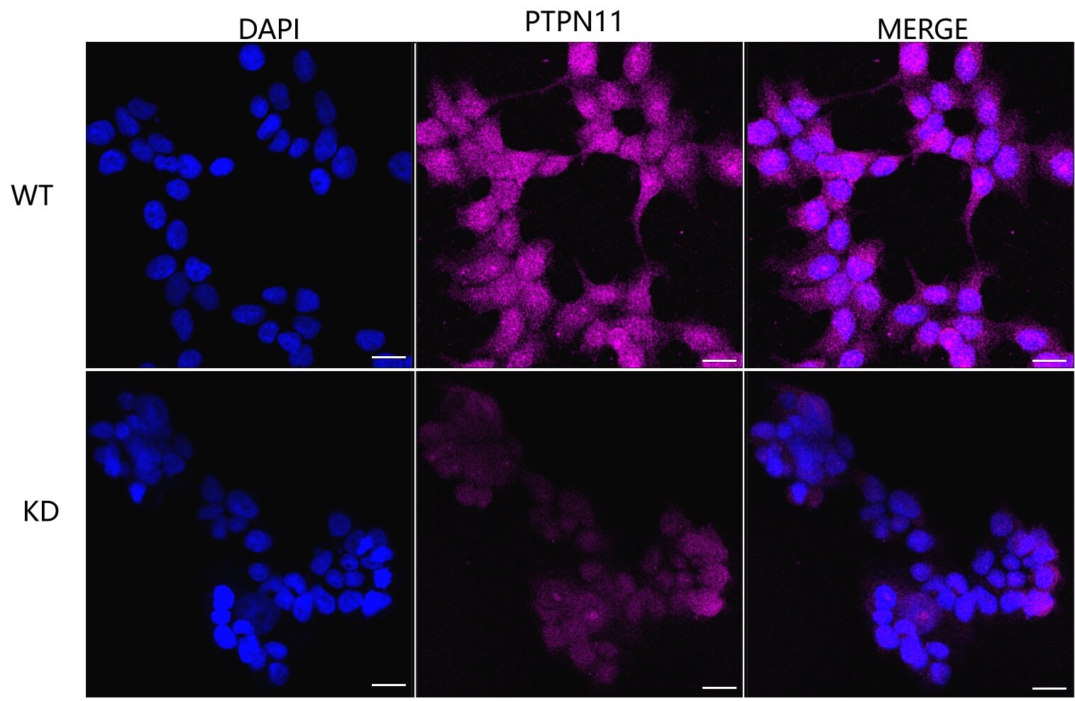 SHP-2/PTPN11 Antibody (23GB2670)