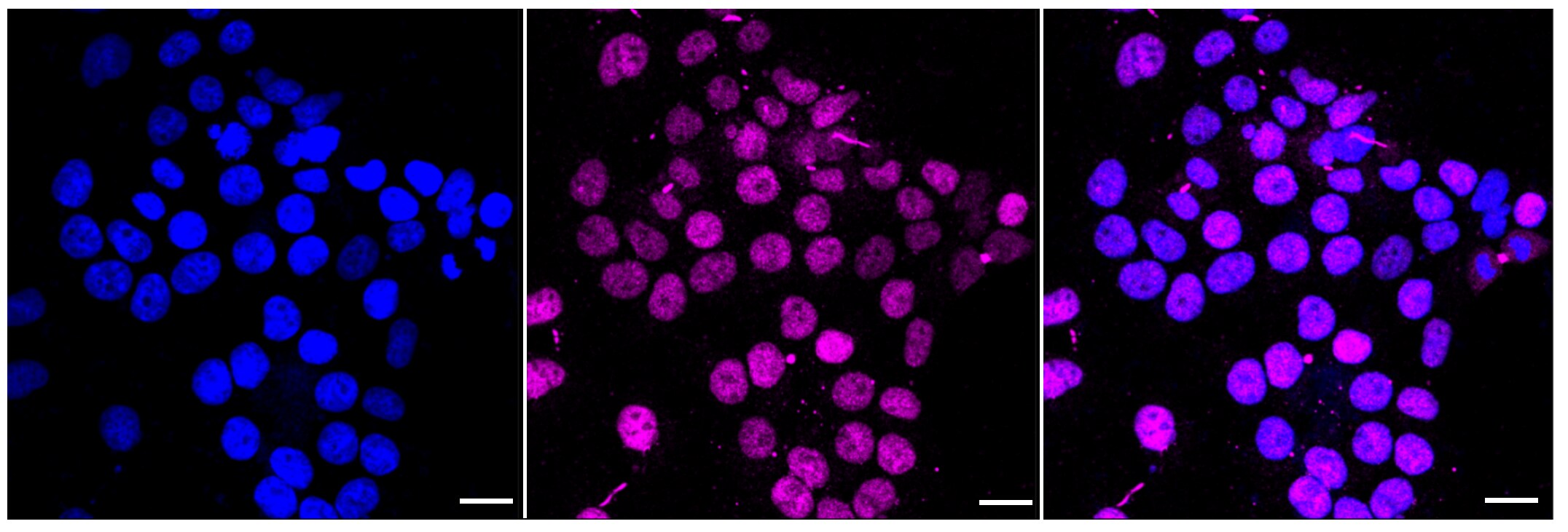 RXR alpha/NR2B1 Antibody (23GB2815)