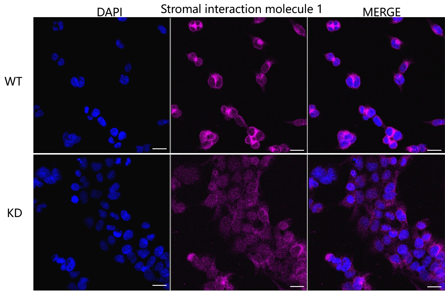 STIM1 Antibody (23GB2415)