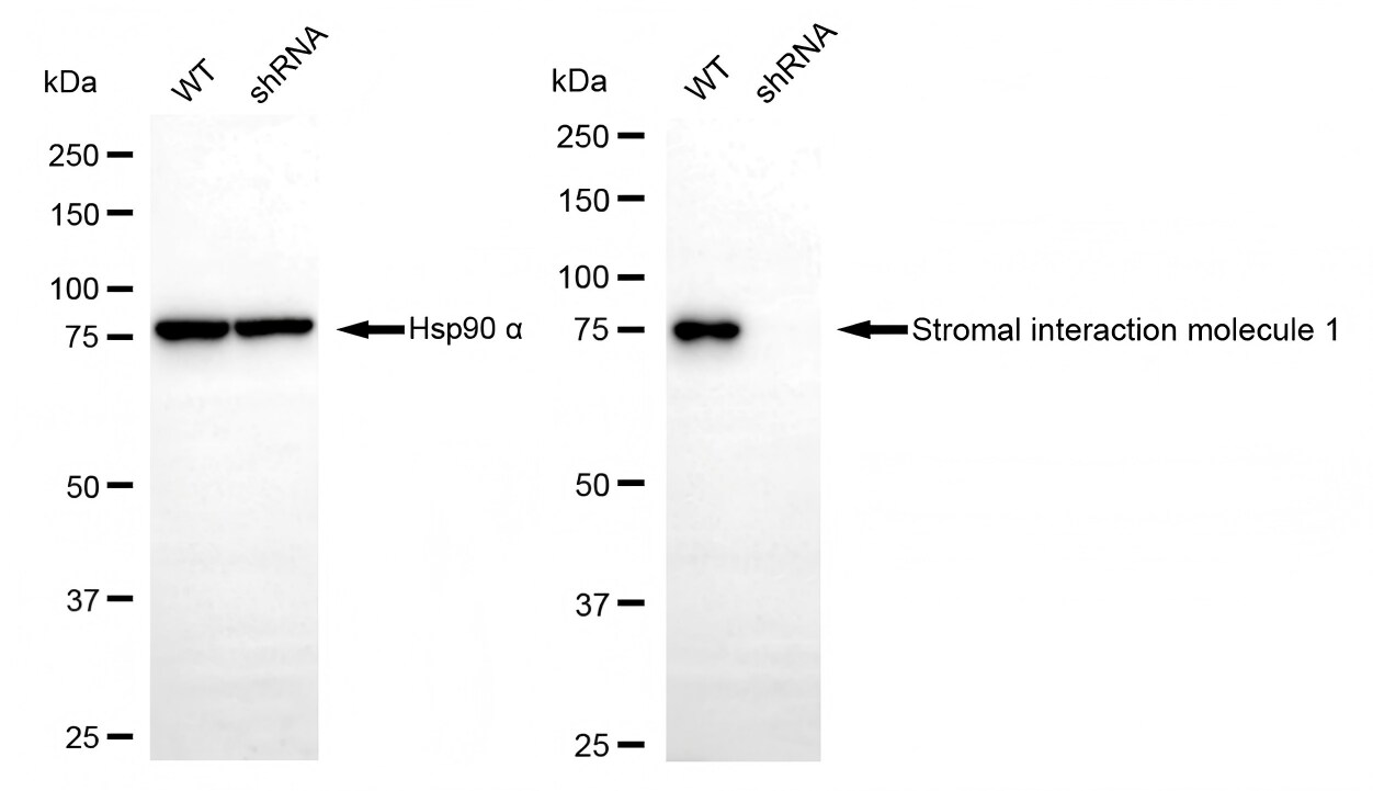 STIM1 Antibody (23GB2415)