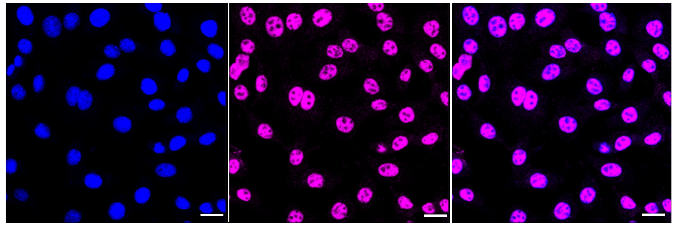 TDP-43/TARDBP Antibody (23GB2405)