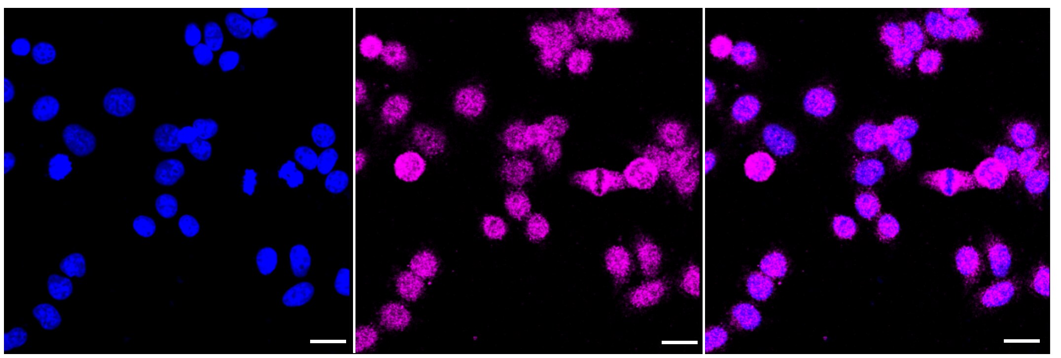 TEAD1 Antibody (23GB2800)