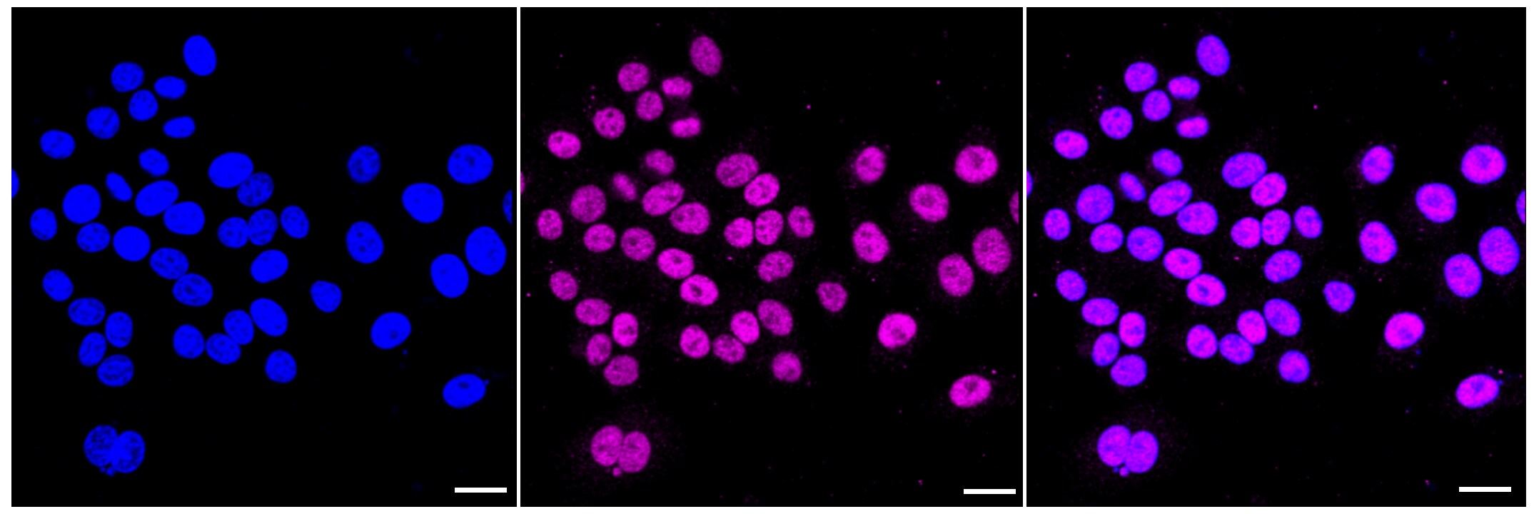 TEAD1 Antibody (23GB2795)