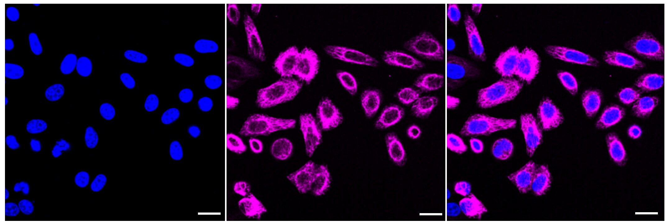 Wnt-5a Antibody (23GB2400)