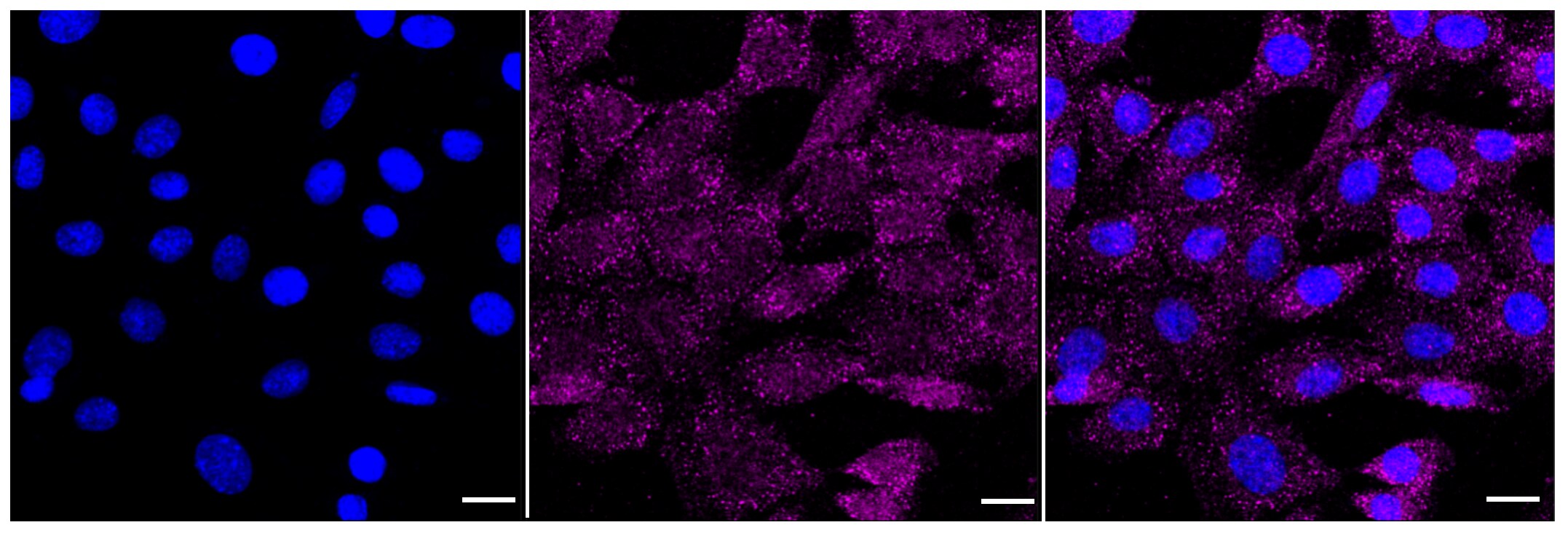 NFkB1/NFkB p105 Antibody (23GB2710)