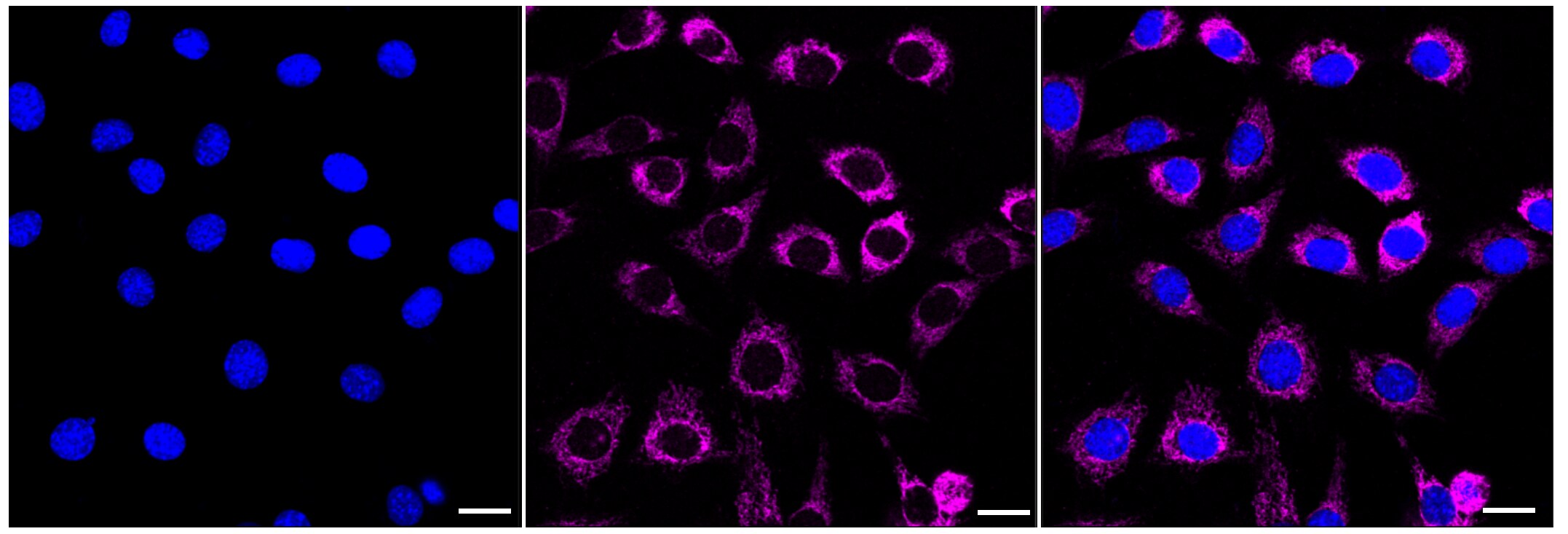 ACAA2 Antibody (23GB2955)