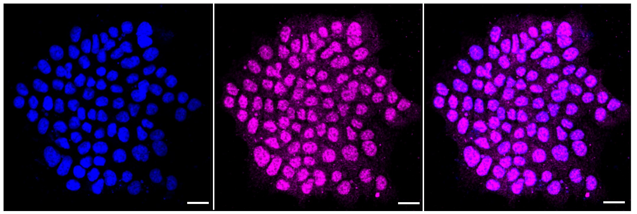 AGL Antibody (23GB2965)