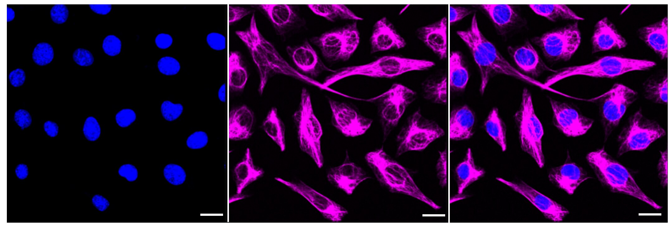 Desmin Antibody (23GB3120)