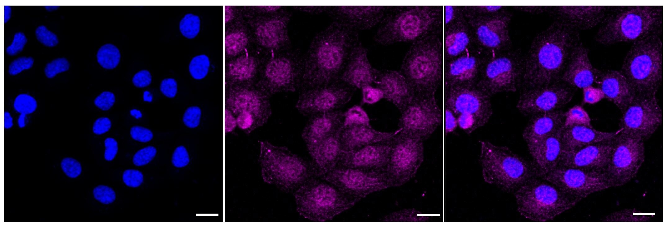 ORP1 Antibody (23GB4065)