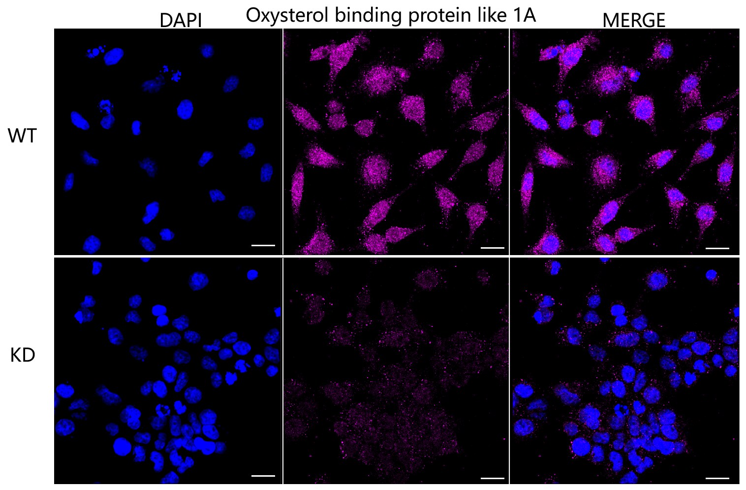 ORP1 Antibody (23GB4065)
