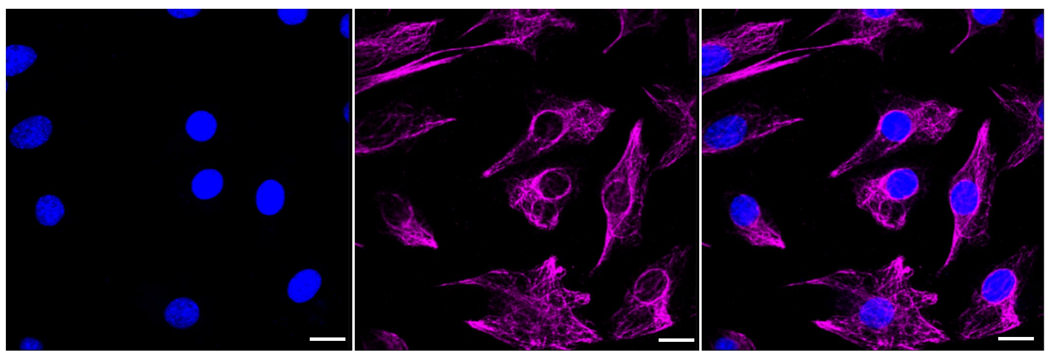 AdipoR1 Antibody (23GB3150)