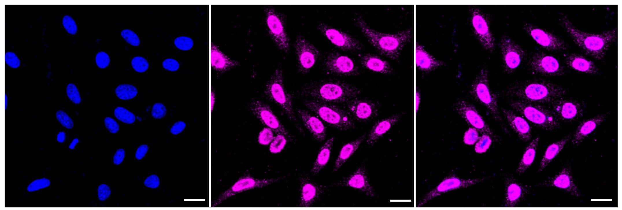 alpha 1-Microglobulin Antibody (23GB3200)