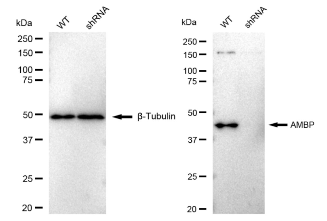alpha 1-Microglobulin Antibody (23GB3200)