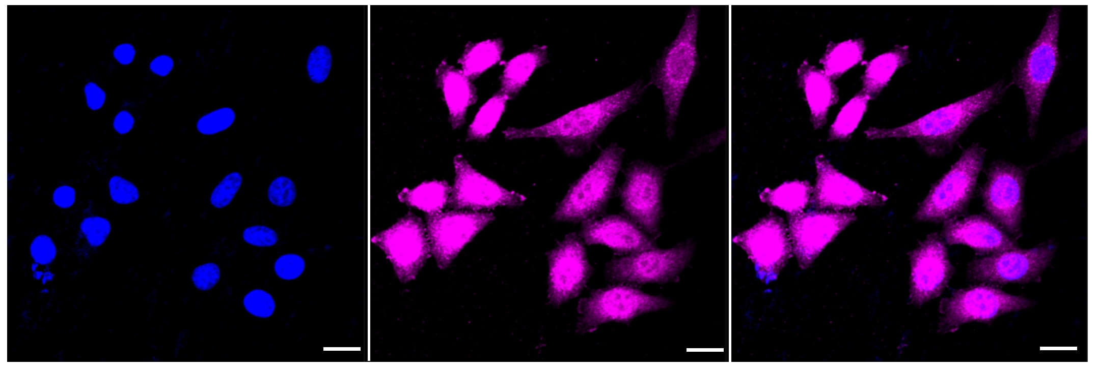 Annexin A10 Antibody (23GB3215)