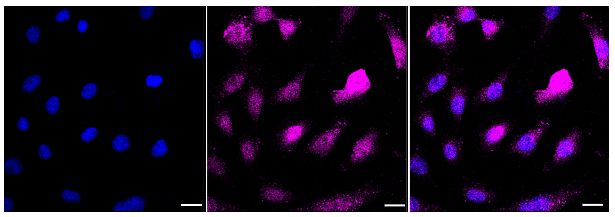 AP2M1 Antibody (23GB3220)