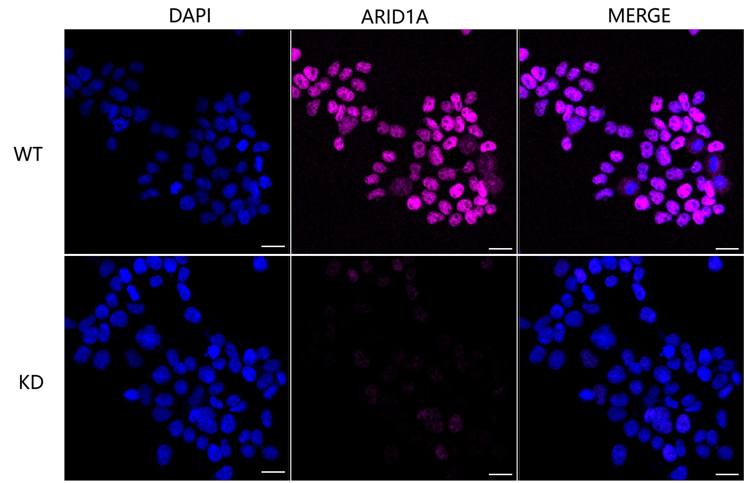 ARID1A Antibody (23GB3230)