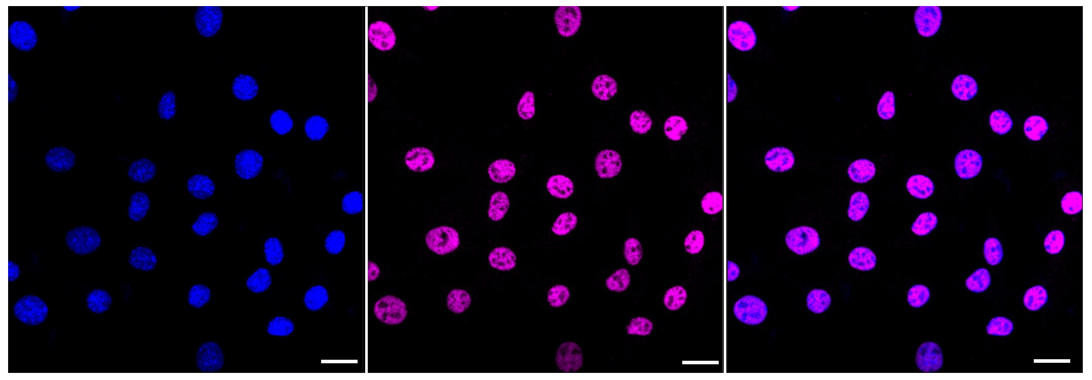 ARID1A Antibody (23GB3230)