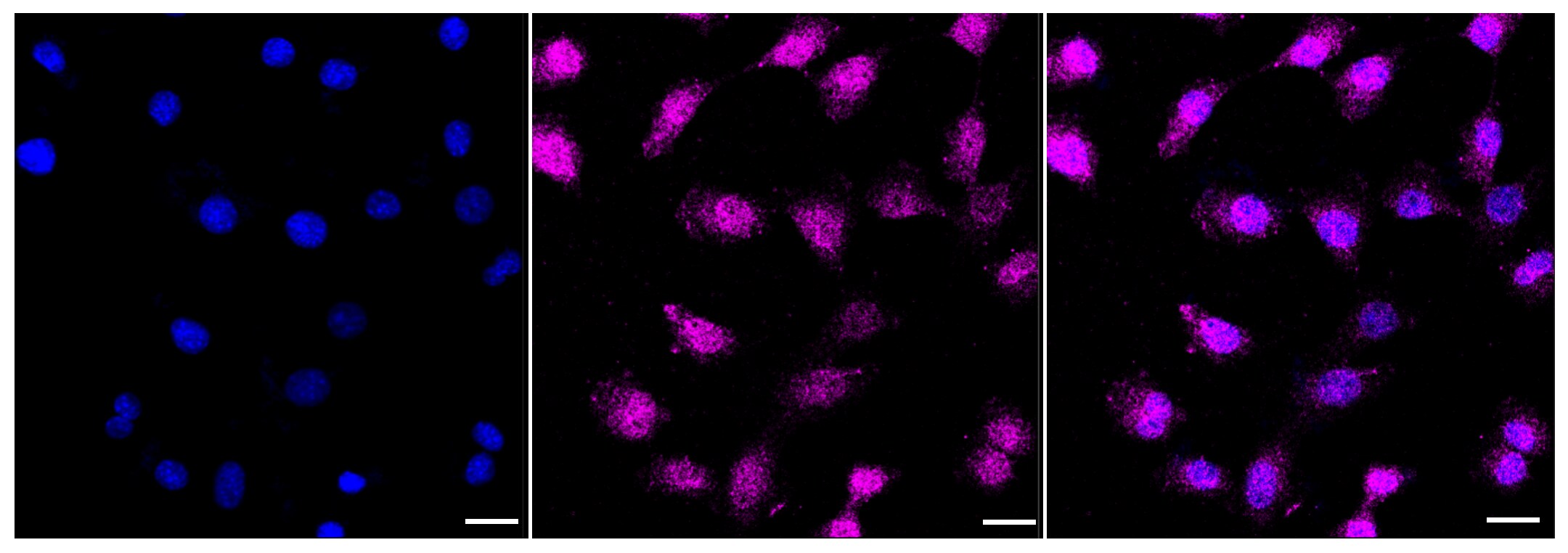 ATG4B Antibody (23GB3240)