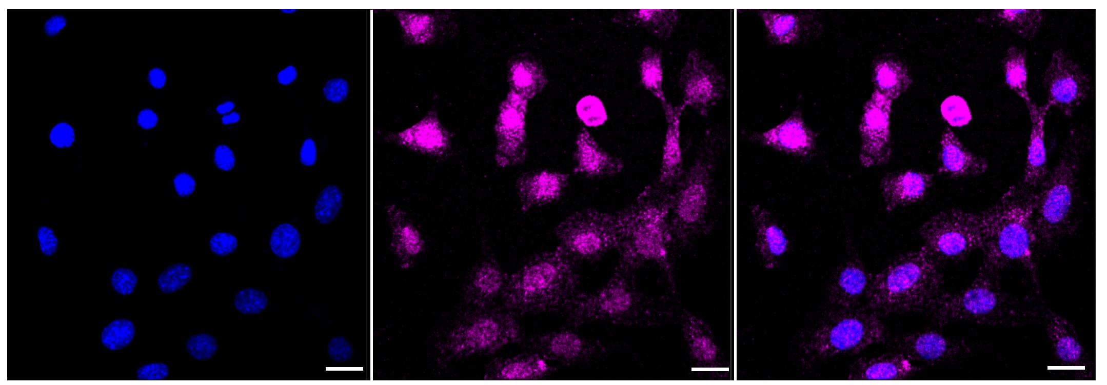 NG2/MCSP Antibody (23GB3470)