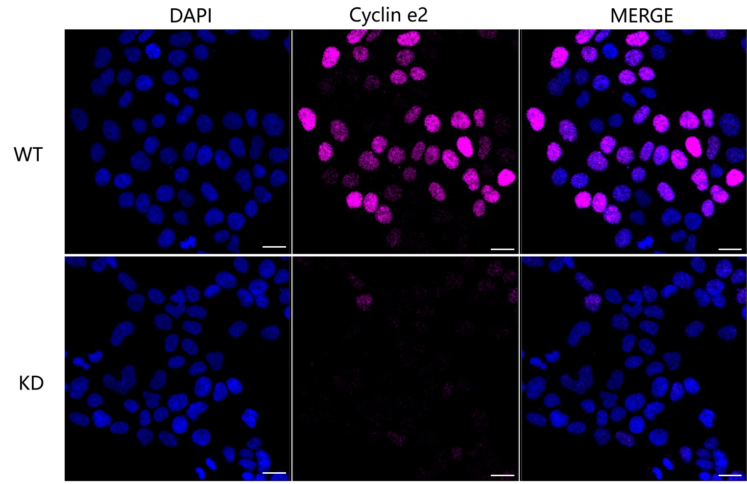 Cyclin E2 Antibody (23GB3535)