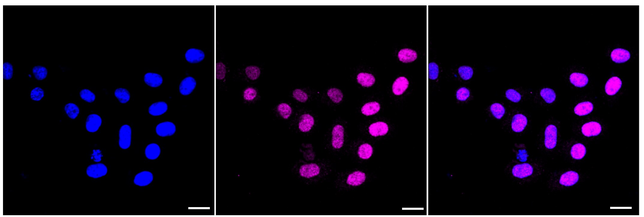 Cyclin E2 Antibody (23GB3535)