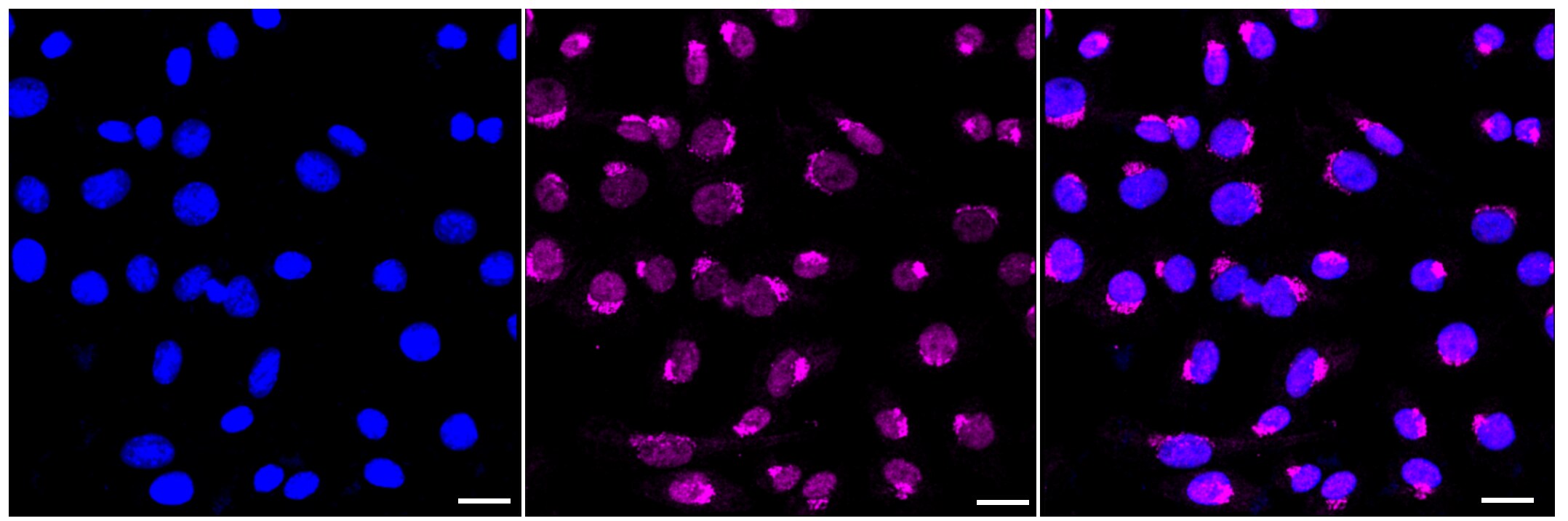 VPS35 Antibody (23GB4260)