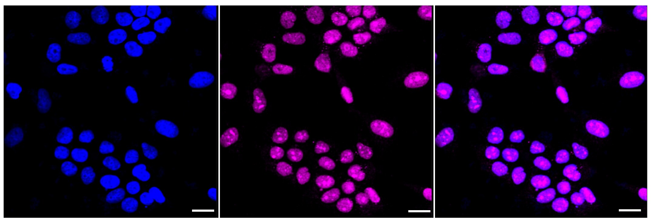 DEK Antibody (23GB3570)