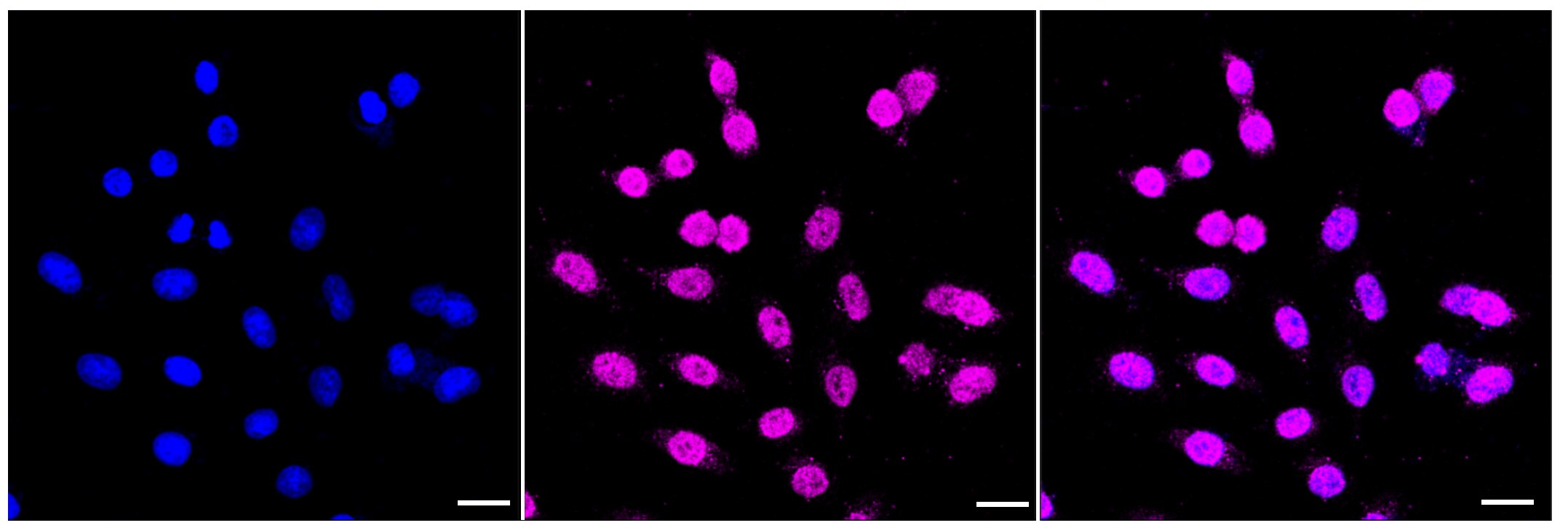 Gamma Adaptin Antibody (23GB3655)